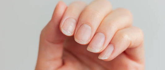 Noticed Uneven Nails? What Ridges in Fingernails Mean and How to Care for Them